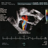 Bad Sector - Dolmen Factory (1999)